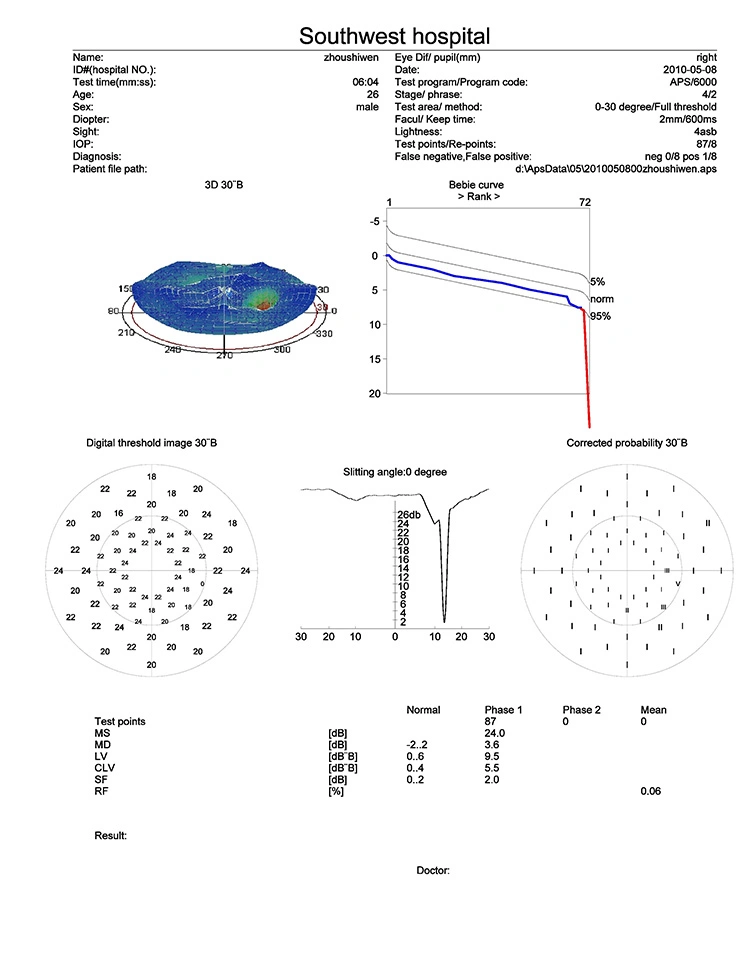 Vision Field Analyzer, Computerized Auto Perimeter, Visual Field Analyzer