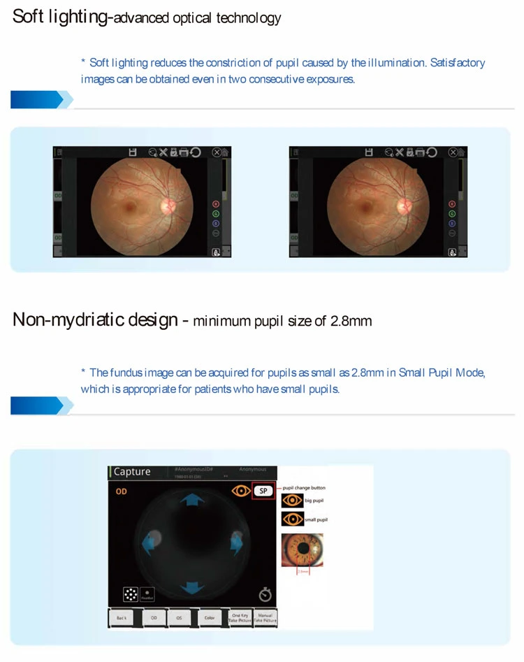 My-V036D Medical Optical Instruments Non Mydriatic Retinal Eye Fundus Camera Ophthalmology