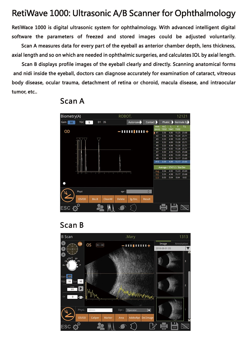 Optics High Quality Ophthalmic Ultrasonic Digital A/b Scanner Retiwave 1000 For Ophthalmology